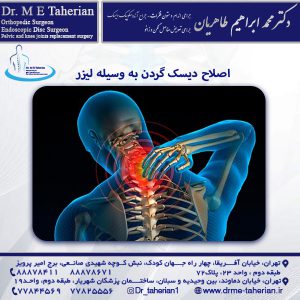 اصلاح دیسک گردن به وسیله لیزر - دکتر محمد ابراهیم طاهریان