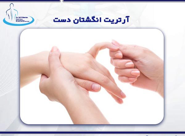 آرتریت انگشتان دست