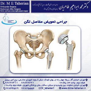 جراحی تعویض مفاصل لگن - دکتر محمد ابراهیم طاهریان
