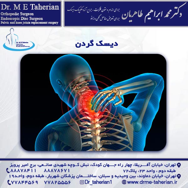 دیسک گردن
