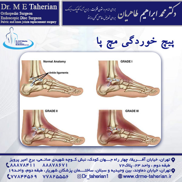 پیچ خوردگی مچ پا - دکتر محمد ابراهیم طاهریان