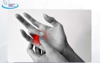 بیماری انگشت ماشه ای و روش های درمان آن