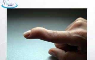 انگشت چکشی - دکتر محمد ابراهمی طاهریان https://drme-taherian.ir/