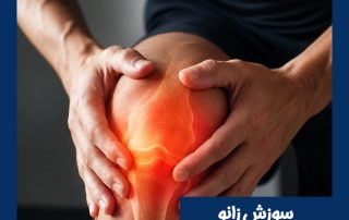سوزش زانو - دکتر طاهریان