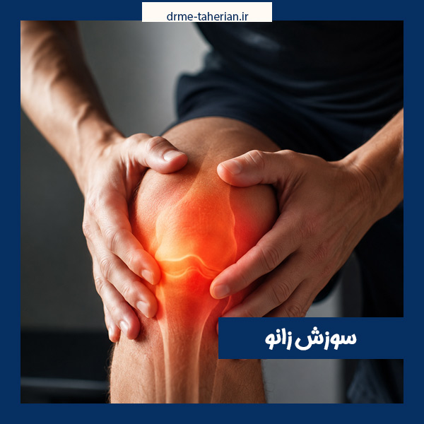 سوزش زانو - دکتر طاهریان